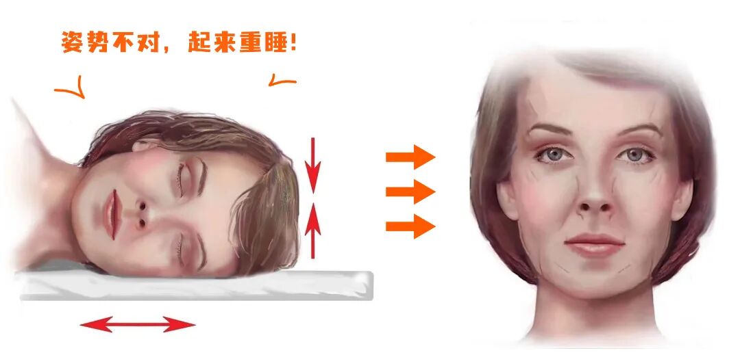 侧睡.jpg
